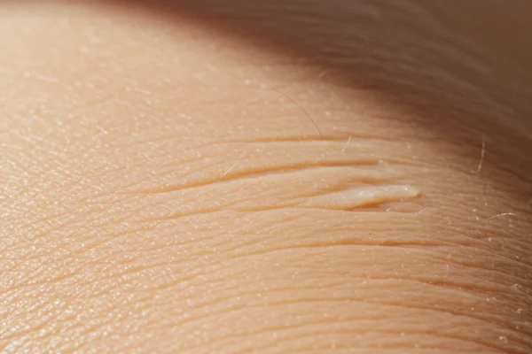Waxing Damage: Save Your Skin’s Elasticity in 2026